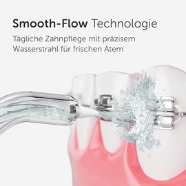 Wondersmile Periodontal Nozzle - Replacement Nozzles for Waterflow Oral Irrigator - SmoothFlow Technology for Optimal Dental & Gum Care (White, Pack of 4)