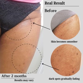 Lurelan Beauty Lightweight moisturizer for even skin tone for bikini area, underarm, face and body, clean natural ingredients