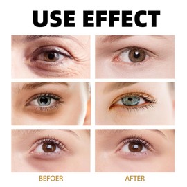 Retinol Intense Reactivating Eye Cream,Retinol Eye Cream,Anti Aging Eye Cream,Under Eye Cream,Eye Cream for Dark Circles and Puffy Eyes,Eye Bags Remover,Eye Cream Anti Aging,Anti Wrinkle Eye Cream