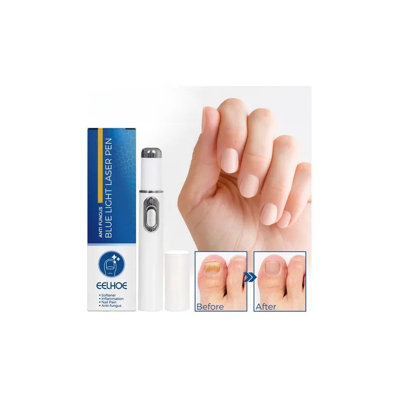 Pluma Luz Azul Elimina Hongo Cuidado Uñas Reparacion Láser F