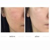 ATHE Melaser Programming Amoule For Melanin Care 10ml (For One