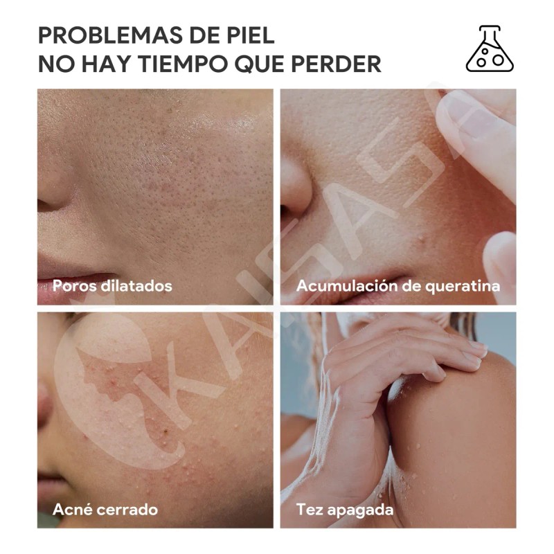 Kaisasa Solución Tónico Reparador Anti Acné Ácido Glicólico