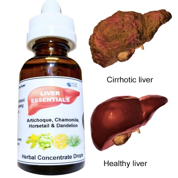 Liver Cleanse Fatty Liver Purifier Detox Herb Drops Artichoke Dandelion ALKAVITA