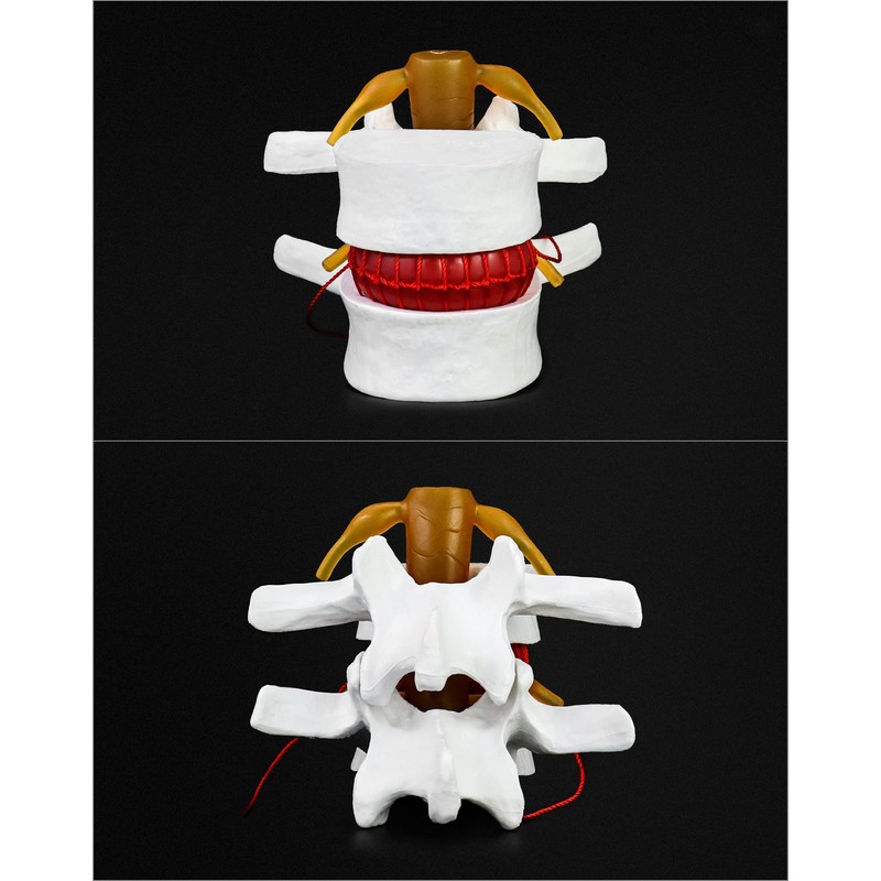 QWORK Anatomical Human Lumbar Vertebrae Degenerative Spine Model - for