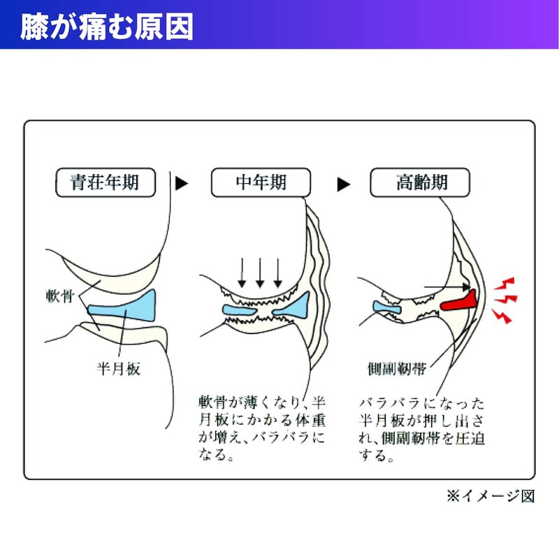 Bamboo Tiger Girdle OA Plus Knee Joint Band Beige S