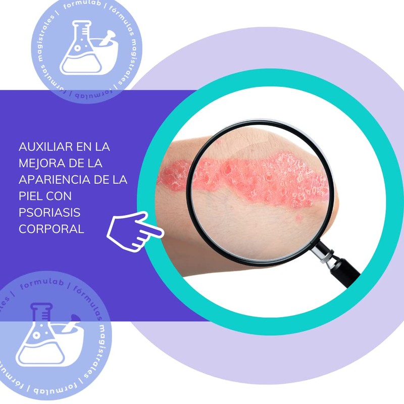Psorialivio, Pomada a base de ácido salicílico concentrado al 5%