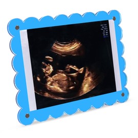 Magnetic Blue Acrylic Scalloped Baby Ultrasound Picture Frame - Sonogram Frame Display for Pregnancy Announcement, Gender Reveal & Expecting Parents Gifts – Ideal for First Time Dad Gifts (Blue)