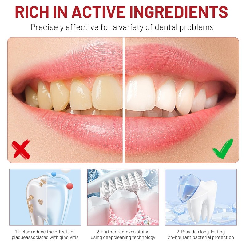 Sp10 Probiotic Toothpaste, 2PCS 100g Sp-10 Ultra Whitening Toothpaste, Deep