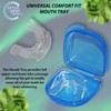 Bright White Smiles Advanced Teeth Whitening Kit - LED Light