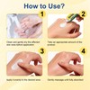 Psoriasis Cream 20g,Intensive Moisturising Cream for Very Dry, Flaky Skin
