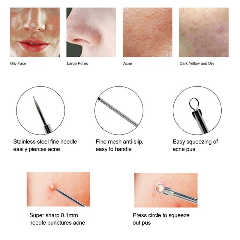 Blackhead Removal Rechargeable 5 Adjustable Suction Electric Pore Acne Cleaner