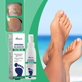 Ximonth Tea Tree Oil Foot Spray | Cracked Heels & Athlete’s Foot Relief | 48H Odor Control | Callus & Nail Care - Specification: 1PCS