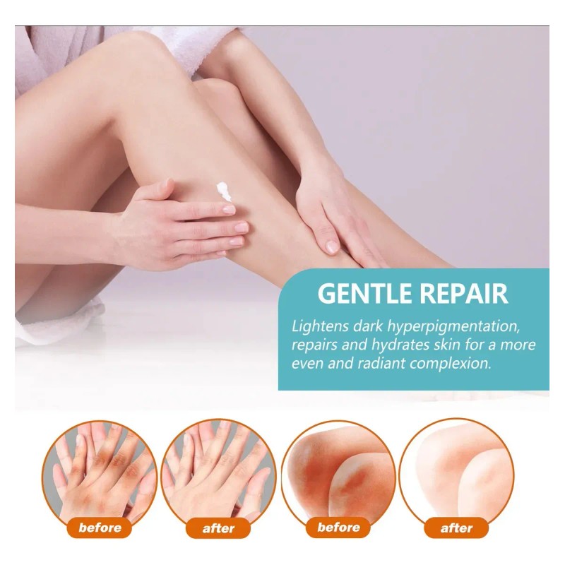 Fixderma Nigrifix Crema Acantosis Nigricans Fbg Agua