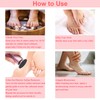 HayZBao HayZBao High Torque Electric Foot File - Callus Remover