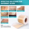 Silicone Scar Sheets, Silicone Scar Tape(1.8” x 157” Roll-4M), Scar