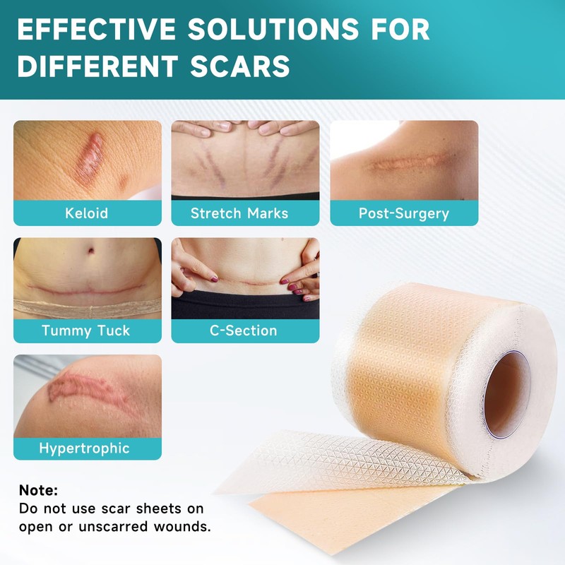Silicone Scar Sheets, Silicone Scar Tape(1.8” x 157” Roll-4M), Scar