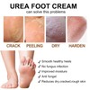 Urea Creme 40 prozent 150 Gramm || Hornhautentferner Fußcreme, Handcreme,