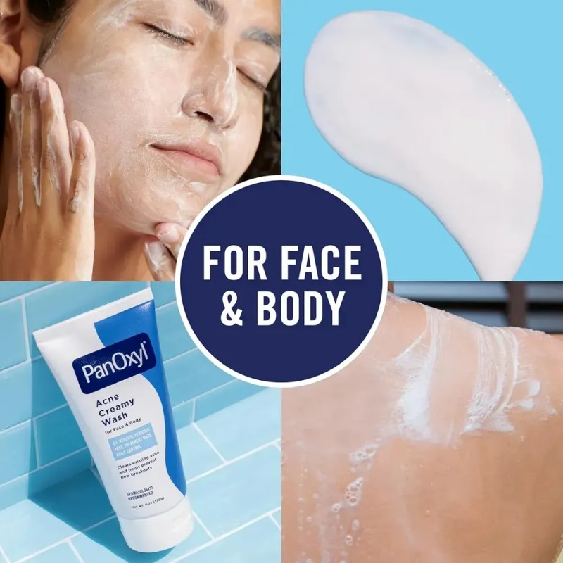 Tn Limpiador Para Acné Panoxyl Acne Wash 170 G Con
