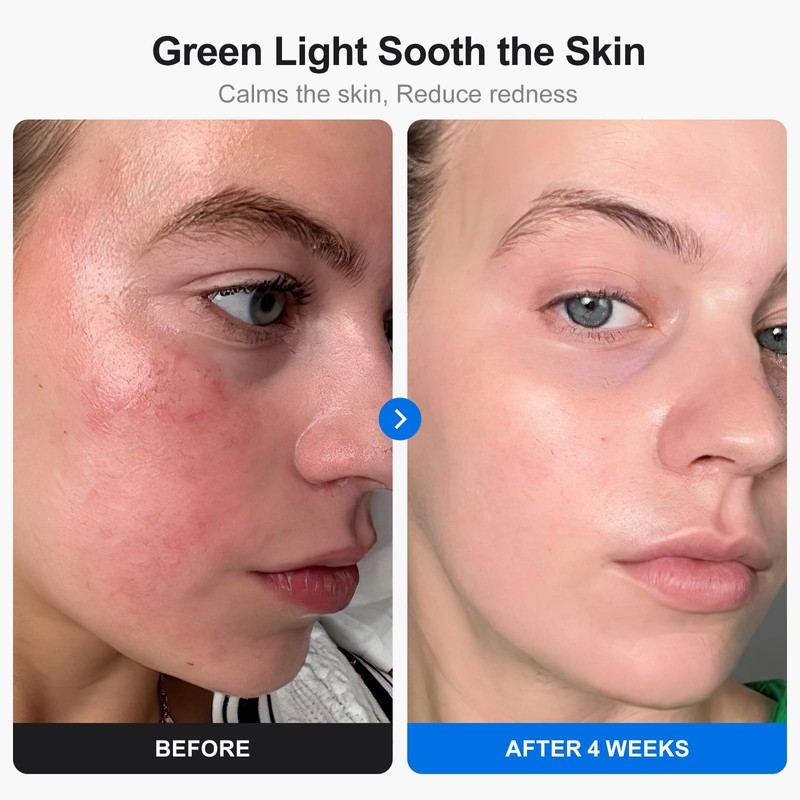 Profey LED Face Mask with 7 Colours, Red Light Mask