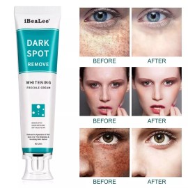 iBeaLee Whitening Freckle Cream Remove Melasma Dark Spots Cream Anti-Aging 20ml