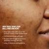Advanced Microdermabrasion Face Exfoliator by Dr. Brandt for Unisex -