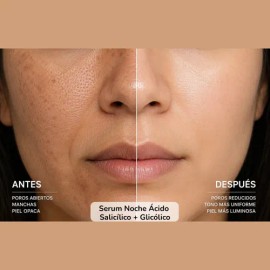 Serum Noche Ácido Salicílico + Glicólico Anti Acné Y Manchas