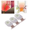 10pcs Colostomy Bag Prevents Leakage Innovatively Non Woven Drainable Ostomy