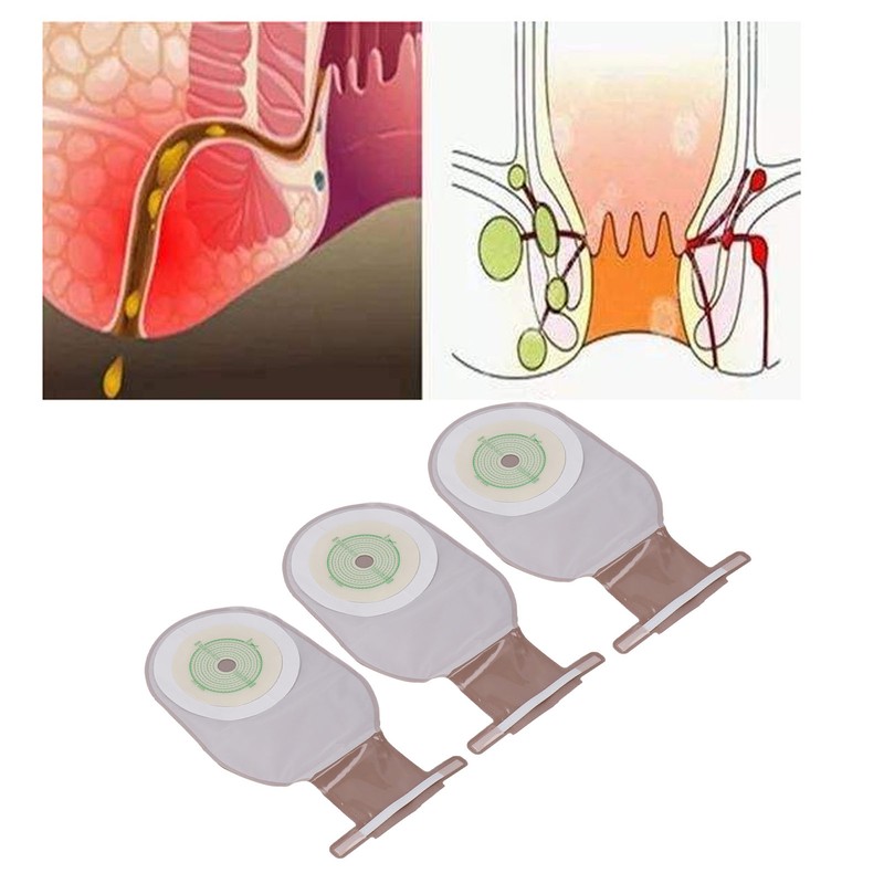 10pcs Colostomy Bag Prevents Leakage Innovatively Non Woven Drainable Ostomy