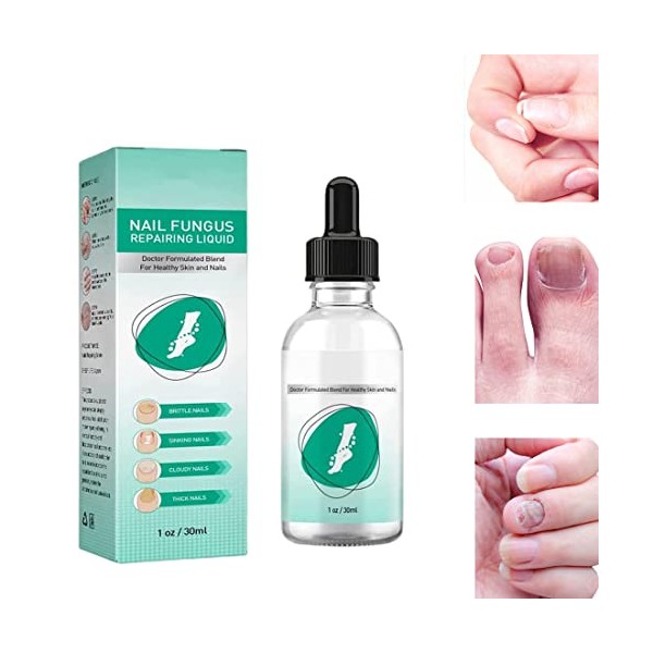 Kerassentials Toenail Fungus Treatment Oil , Best Repair Solution for