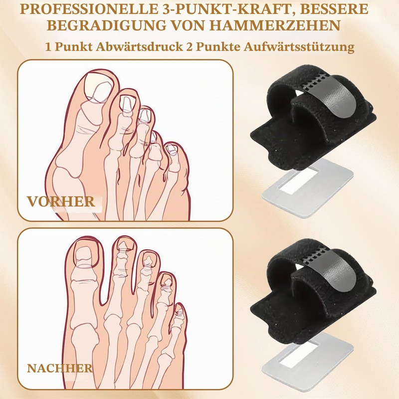 Pack of 2 Black Hammer Toe Splint with Aluminium Plates,