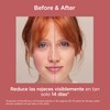 ISDIN FotoUltra Redness SPF 50 50ml Face Sunscreen for Sensitive