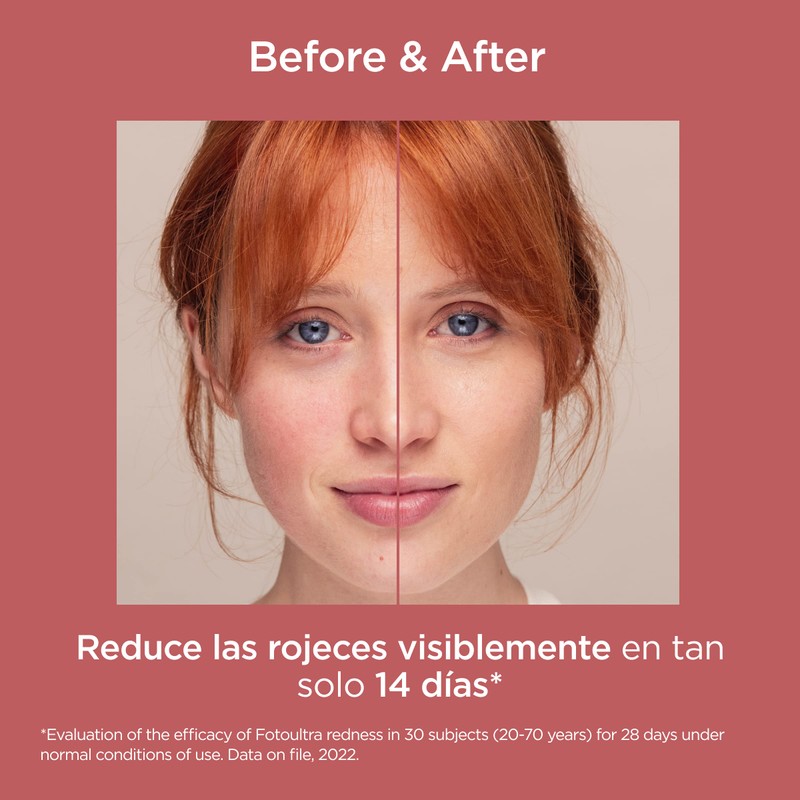 ISDIN FotoUltra Redness SPF 50 50ml Face Sunscreen for Sensitive