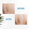 Clean + Easy Electrolysis Machine for Permanent Hair Removal -