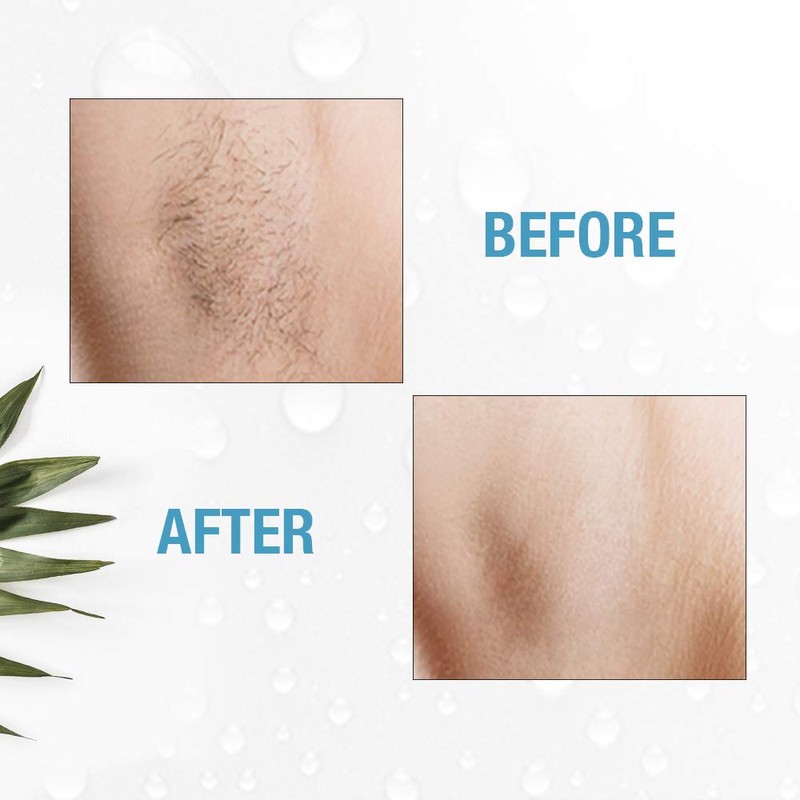 Clean + Easy Electrolysis Machine for Permanent Hair Removal -