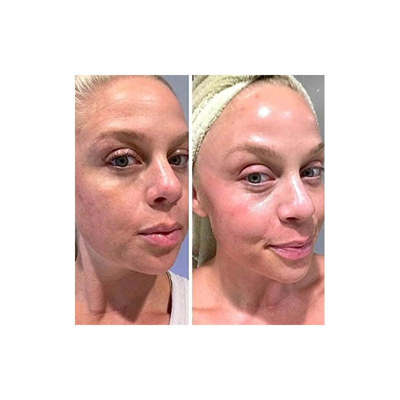 Retinol Gel 0.1 Vitamin A Repairs Fine Lines Wrinkles, Scar