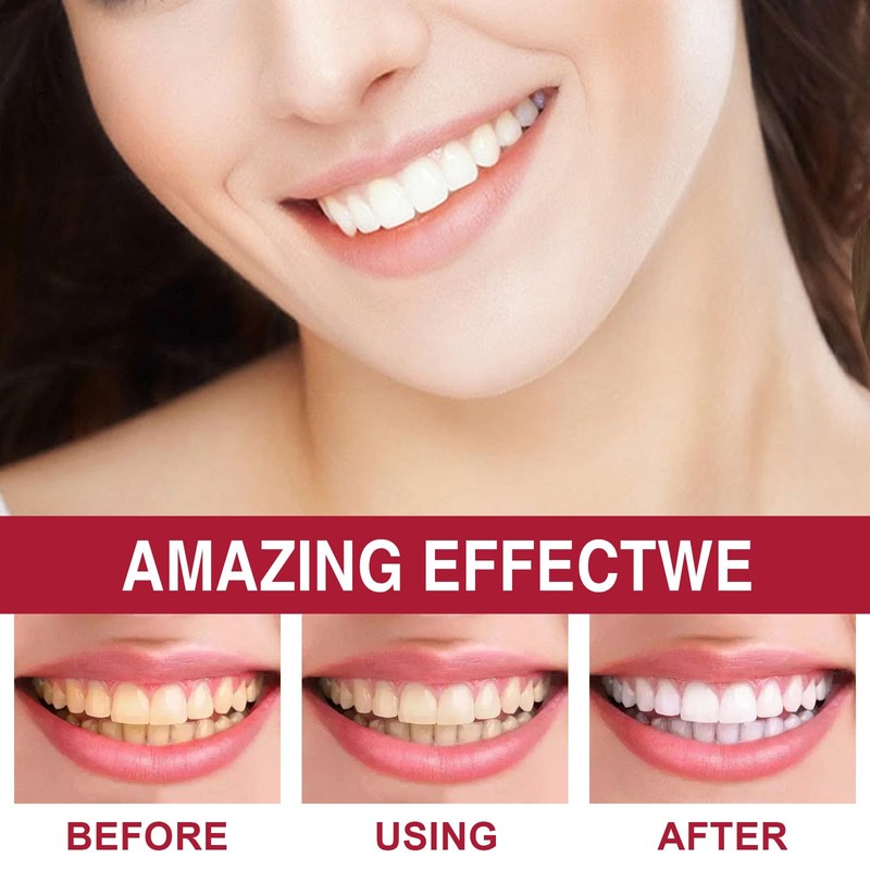 SP-6 Probiotics Whitening Toothpaste, with Probiotics Deep Cleaning Oral Care