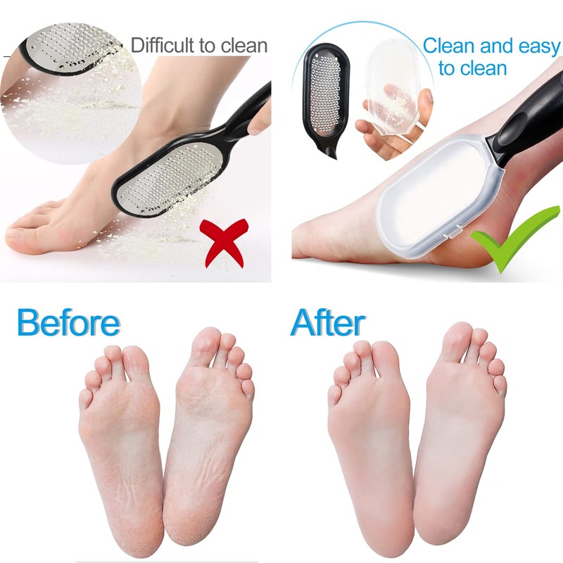 Foot File Callus Remover