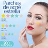 200 SimplePatch Parches Estrella Star Anti Acne Elimina Espinillas, Granos,