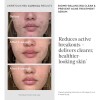 Tratamiento Antiacné Murad Biome-balancing: Suero Con Ácido