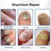 Nail Patches - Toenail Care for Toenail Fingernails - 8-Hour