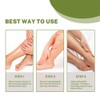 Varicose Veins Cream Natural Ointment for Varicose and Spider Veins