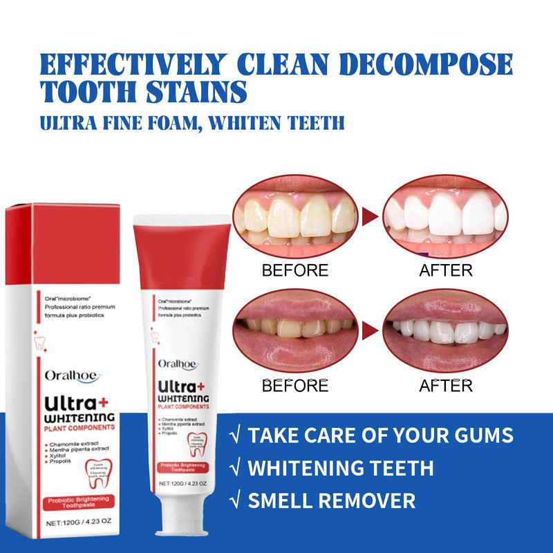 Sp-6 Toothpaste, 120 G Probiotics Bright White Toothpaste Toothpaste Sp-6