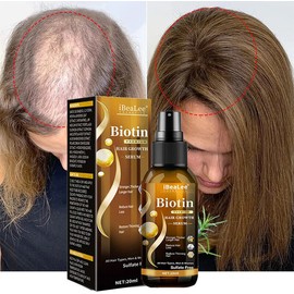 Unbranded Biotin Hair Growth Spray Anti Hair Loss Fast Regrowth Scalp Treatment Serum-2025