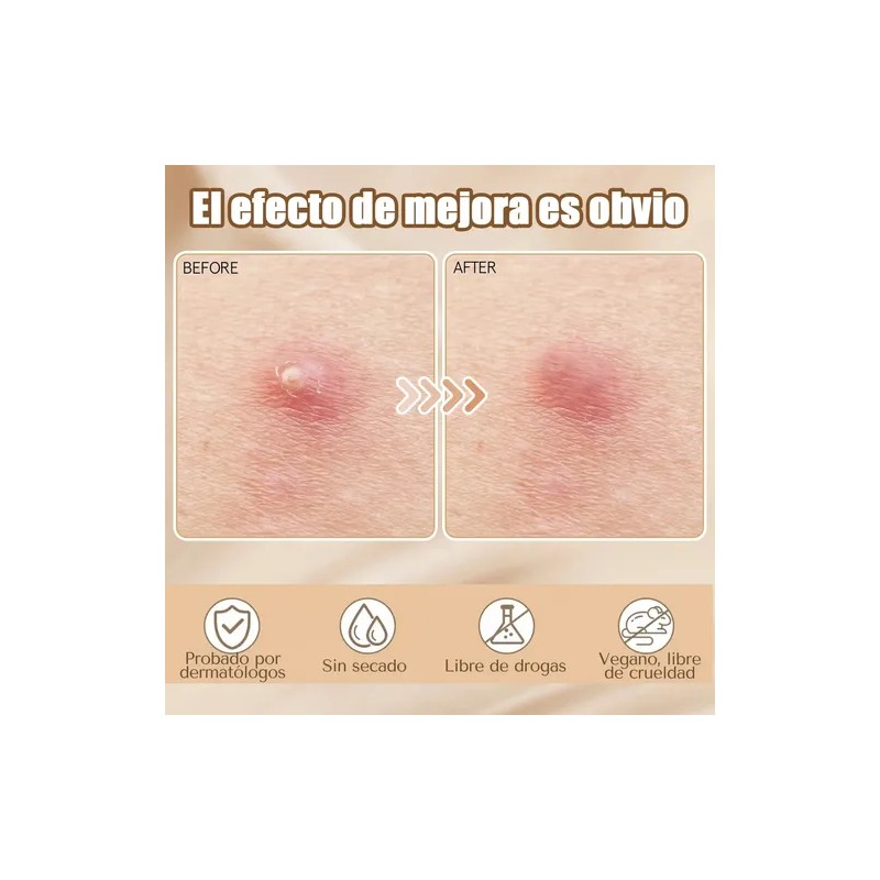 432pzs Parches Estrella Star Anti Acne Espinillas Granos