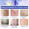 Self-adhesive Silicone Scar Patch 1.6x120 inches Transparent Invisible Scar Sheets