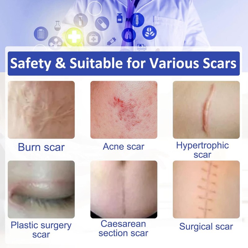 Self-adhesive Silicone Scar Patch 1.6x120 inches Transparent Invisible Scar Sheets