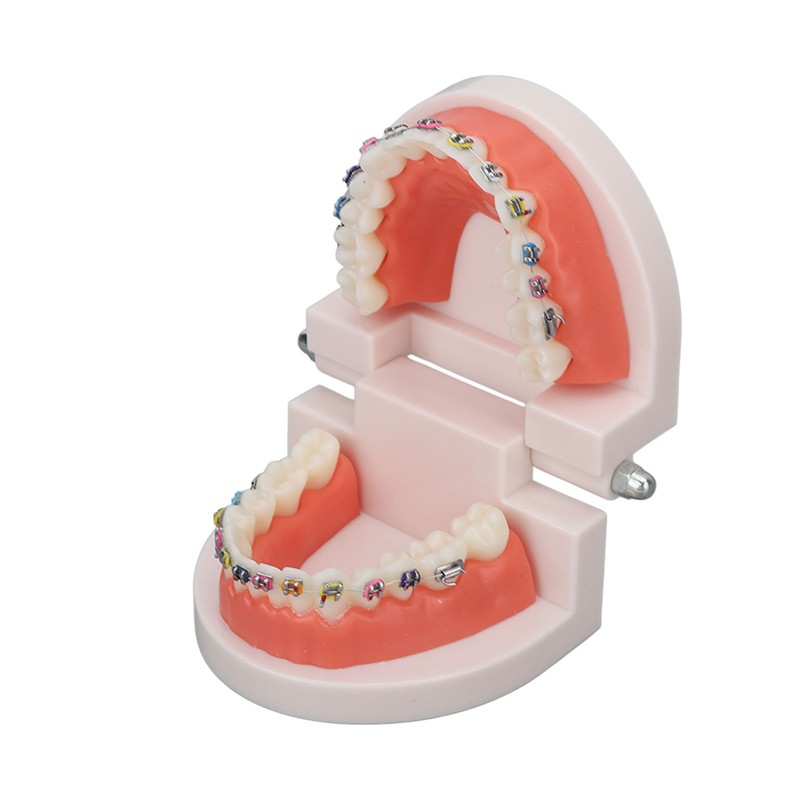 Dental Typodont Teeth Model with Orthodontic Metal Bracket for Dentist