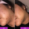 Sérum Despigmentante Good Molecules con Niacinamida y Ácido Tranexámico para
