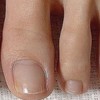 손톱끝갈라짐 조갑박리증 큐티클오일대용량 손톱거스러미영양제 Nail Splitting, Nail Bed Separation Cuticle