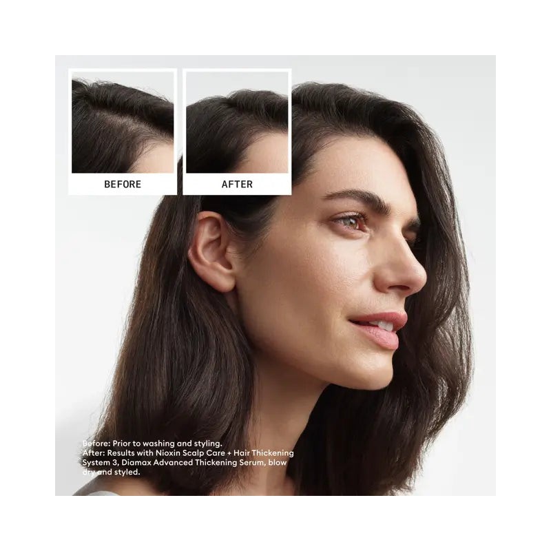 Nioxin Scalp + Hair Thickening System 3 Full Size Kit